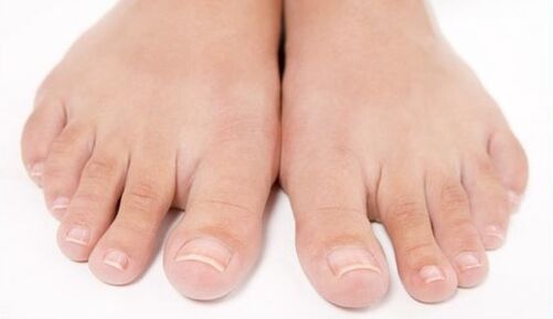 pés sans despois do tratamento con fungos